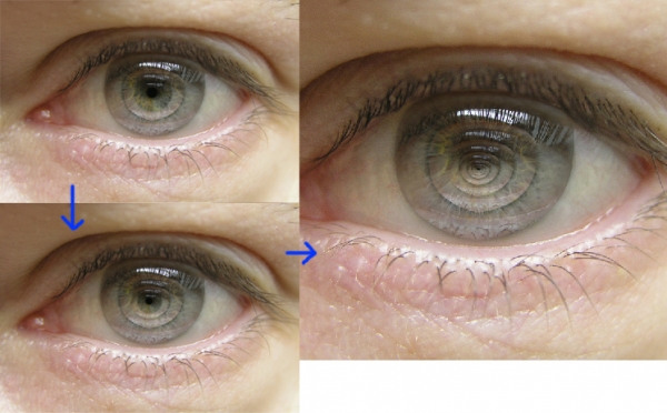 Creation of eye within eye: Step 3